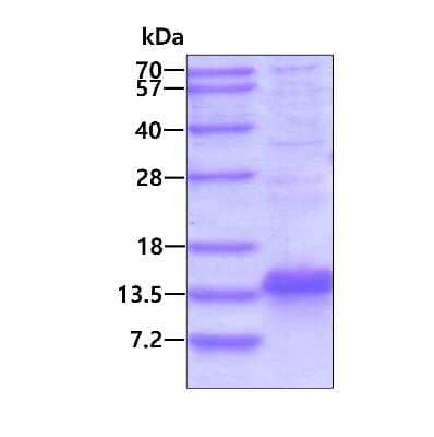 SDS-PAGE: Recombinant Human SERF2 His Protein [NBP2-22813]